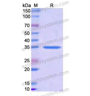 Recombinant Human CRHBP, N-His