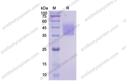 Recombinant Human CD124/IL4R, C-His