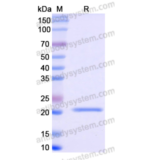 Recombinant Human CYP3A7, N-His