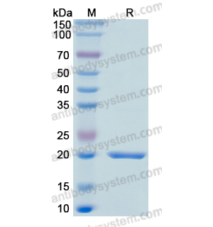 Recombinant Human GADD45A, N-His