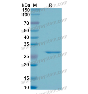 Recombinant Human EEF1B2, N-His