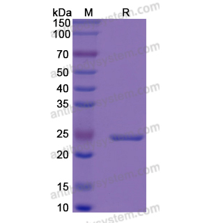 Recombinant Human IGFBP6, N-His