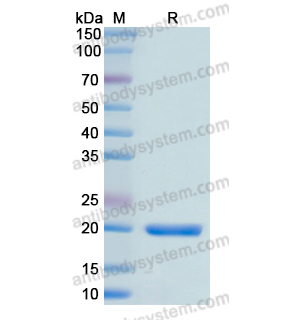 Recombinant Human MYL9, N-His