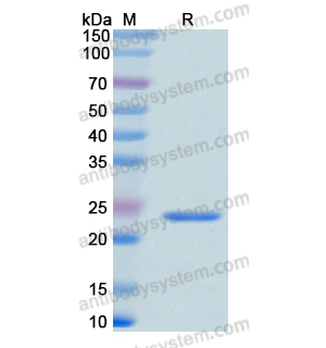 Recombinant Human APC, N-His