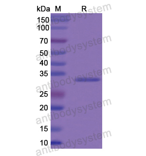 Recombinant Human COL8A2, N-His