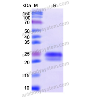 Recombinant Human EDNRA, N-His-SUMO