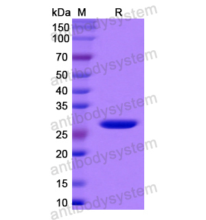 Recombinant Human MPZ, N-His