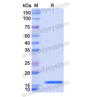 Recombinant Human LAMA1 Protein, N-His