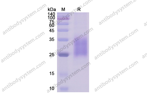 Recombinant Human CD95/FAS, C-His