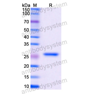 Recombinant Human CTSS, N-His