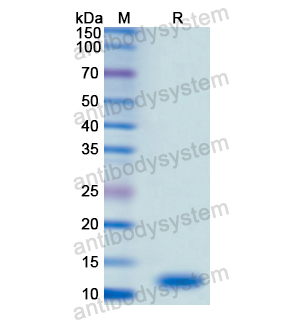 Recombinant Human S100P, N-His（YHD68501）