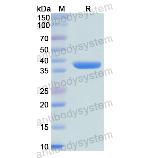 Recombinant Human NPY1R, N-GST