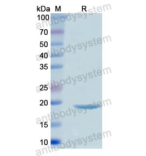 Recombinant Human ITGB8, N-His