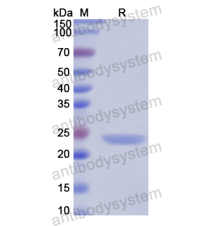 Recombinant Human PTX3, N-His