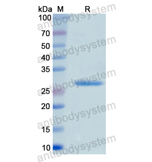 Recombinant Human MSN, N-His（YHD69501）