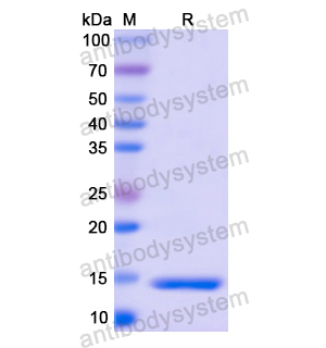 Recombinant Human S100A4, N-His