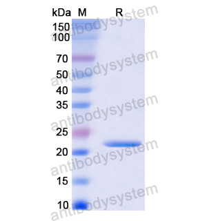 Recombinant Human HMGB2, N-His