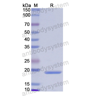 Recombinant Human CALML3, N-His