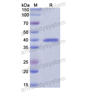 Recombinant Human ARNT/HIF1-beta, N-His