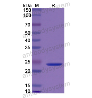 Recombinant Human Calreticulin/CALR, N-His