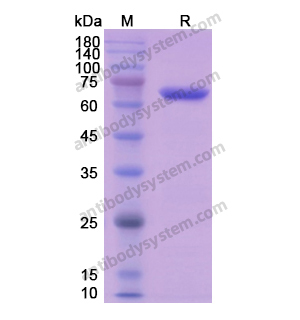 Recombinant Human CANX, N-His