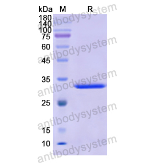 Recombinant Human AOAH, N-His