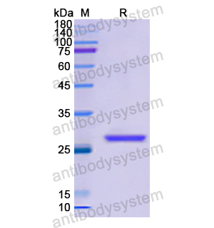 Recombinant Human GSTM2, N-His