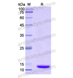 Recombinant Human TMOD1, N-His