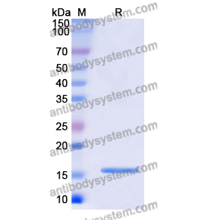 Recombinant Human CST5, N-His