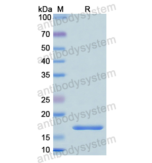 Recombinant Human GCA, N-His