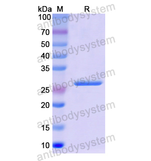 Recombinant Human ERCC5, N-His