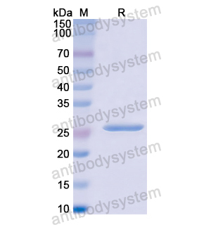 Recombinant Human PTPRM, N-His