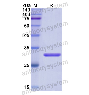 Recombinant Human PCSK1, N-His（YHD81701）