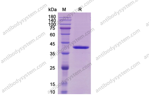 Recombinant Human IL12B/IL-12 p40/NKSF2, C-Flag