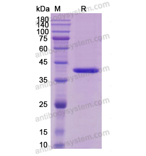 Recombinant Human IL12B/IL-12 p40/NKSF2, C-His