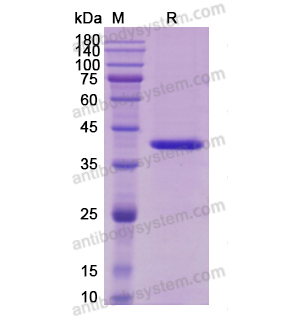 Recombinant Mouse IL12B/IL-12 p40/NKSF2, C-Strep