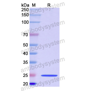 Recombinant Human NOS1, N-His