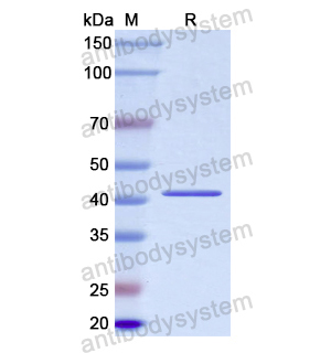 Recombinant Human PML, N-His