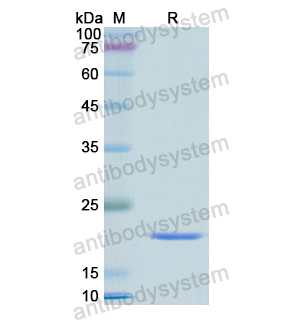 Recombinant Human ATP5F1D, N-His