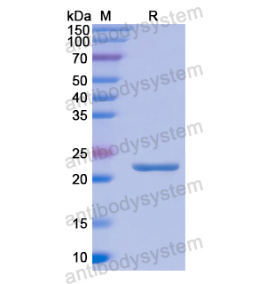 Recombinant Human PEBP1, N-His