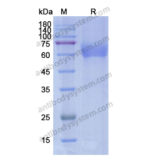 Recombinant Human AXL/UFO, C-His