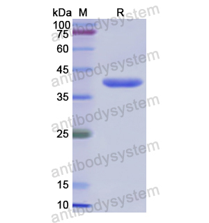 Recombinant Human GRPR, N-GST