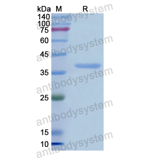 Recombinant Human OXTR, N-GST