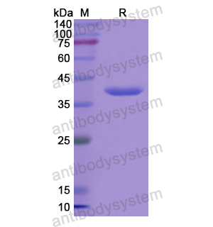 Recombinant Human ADSL, N-His