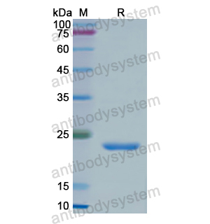 Recombinant Human PKLR, N-His