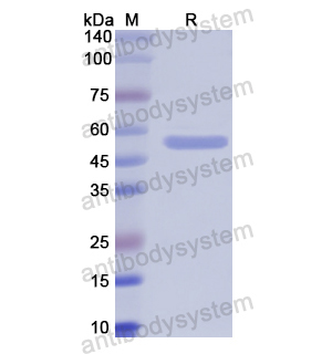 Recombinant Human ALDH1B1, N-His