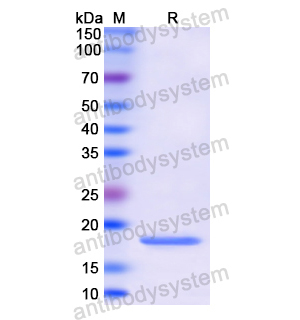 Recombinant Human LCN1, N-His