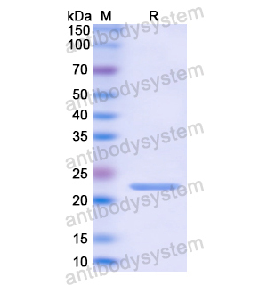 Recombinant Human CORO1A, N-His