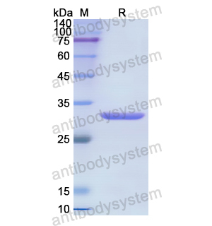 Recombinant Human GDI1, N-His