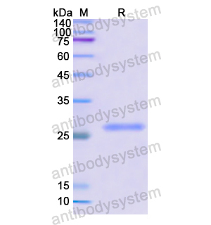 Recombinant Human MAT2A, N-His